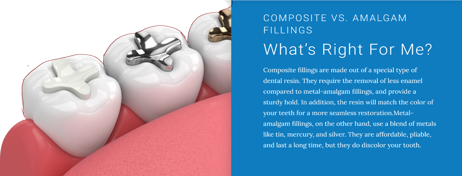 Dental fillings