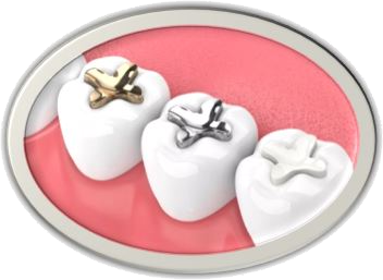 Dental fillings