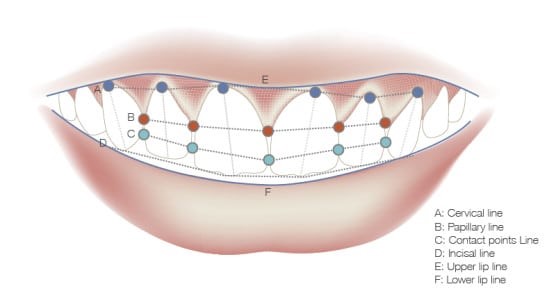 Dental-Implants