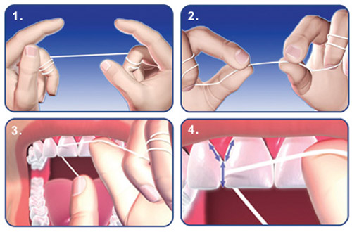 How-to-floss-your-teeth-3