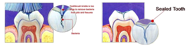 pediatri_dentistry