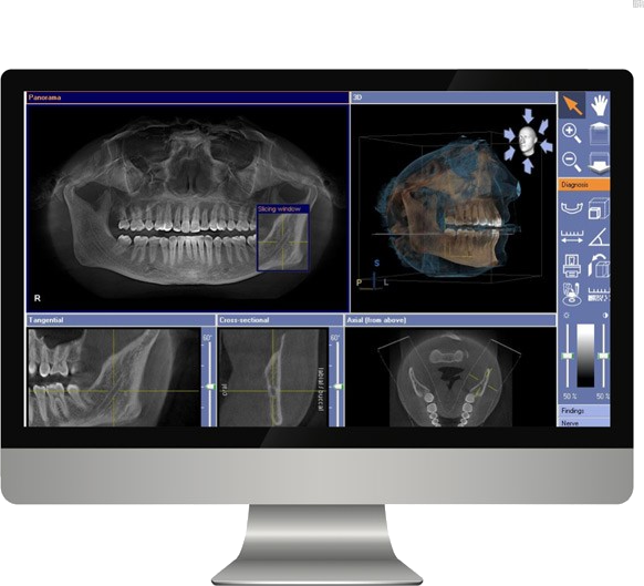 Virtual-Guided-Dental-Implant-Surgery