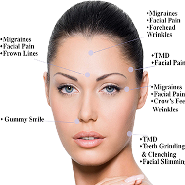 Botox - the Muscle Relaxant Therapy