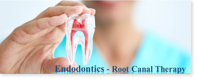 Root_Canal_Treatment